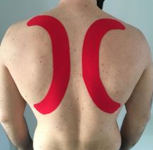 Hooikoorts behandelen medical taping Fysi-co Wijchen