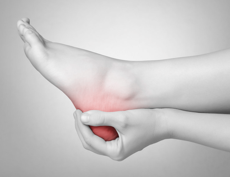 hielspoor behandeling rekken fysiotherapie fysi-co wijchen